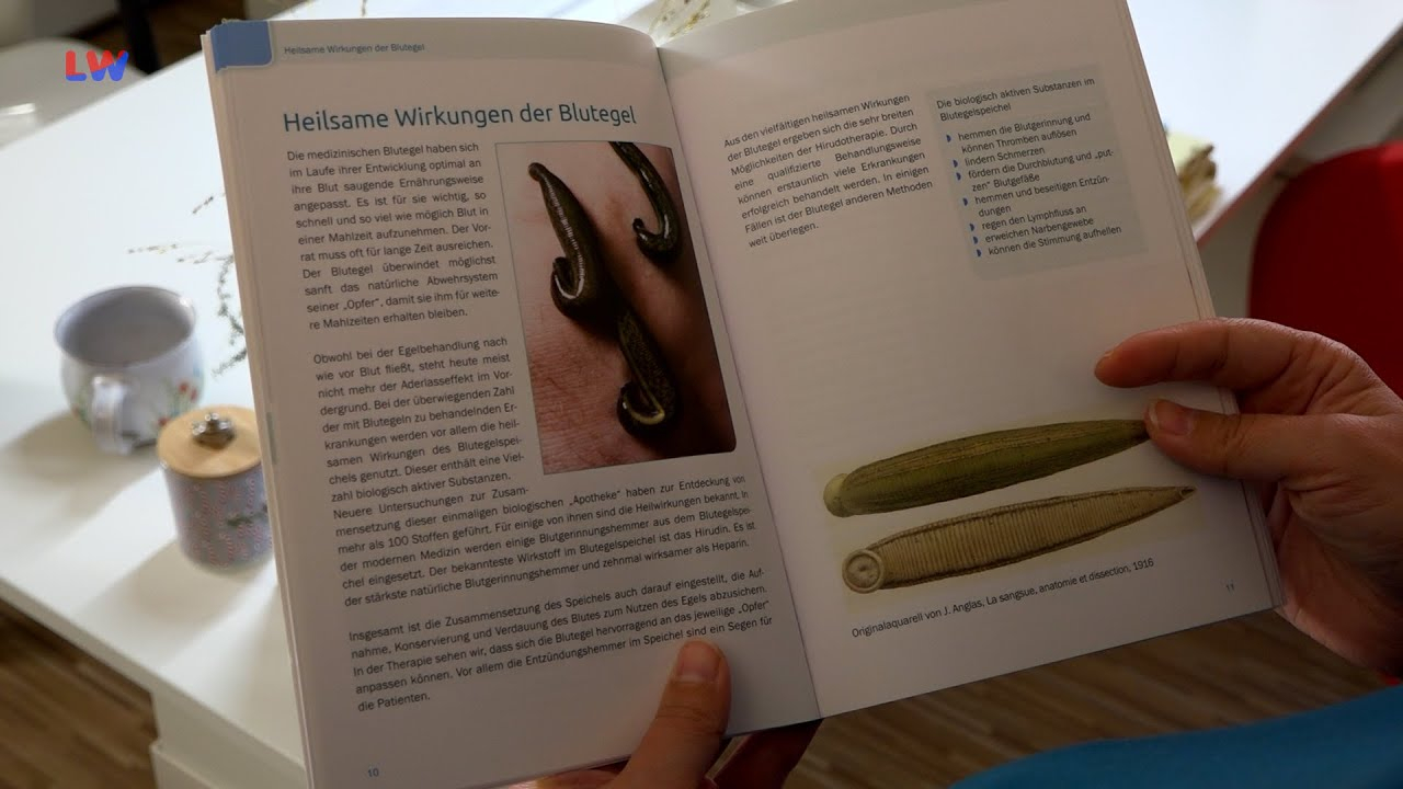 Großröhrsdorf: Tierisches von den Blutegeln