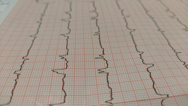 Zittau: Kardiologie umgezogen